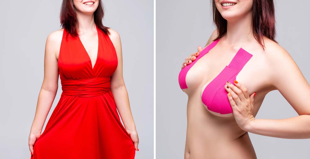 Strapless bra self adhesive silicone invisible push-up, women bra reusable sticky for deep cleavage and backless dresses, before after dressing, studio shot on gray background